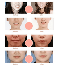 Load image into Gallery viewer, V-Shaped Face Slimming Mask